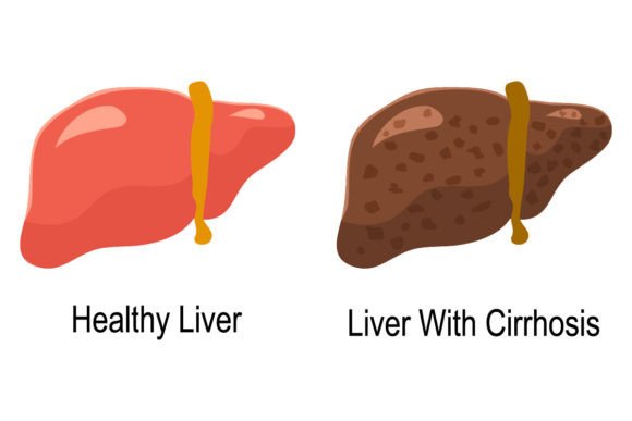 The Power of Visualizing Liver Health